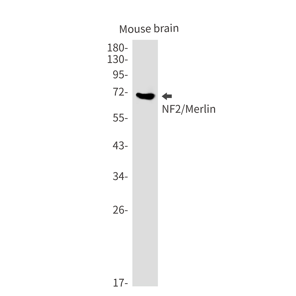 NF2 Rabbit mAb