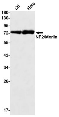 NF2 Rabbit mAb