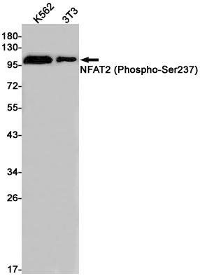 Phospho-NFAT2 (Ser237) Rabbit mAb