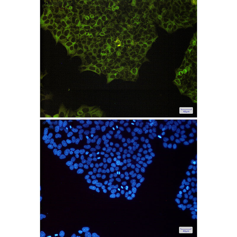 NF-KB p100 Rabbit mAb