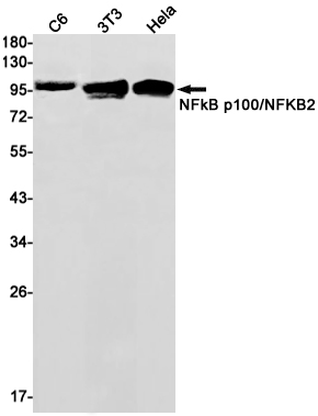 NF-KB p100 Rabbit mAb