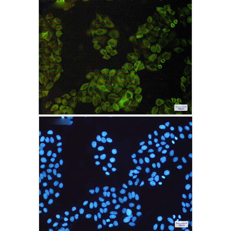 NF-KB p100 Rabbit mAb