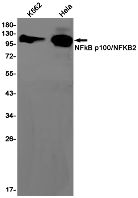 NF-KB p100 Rabbit mAb