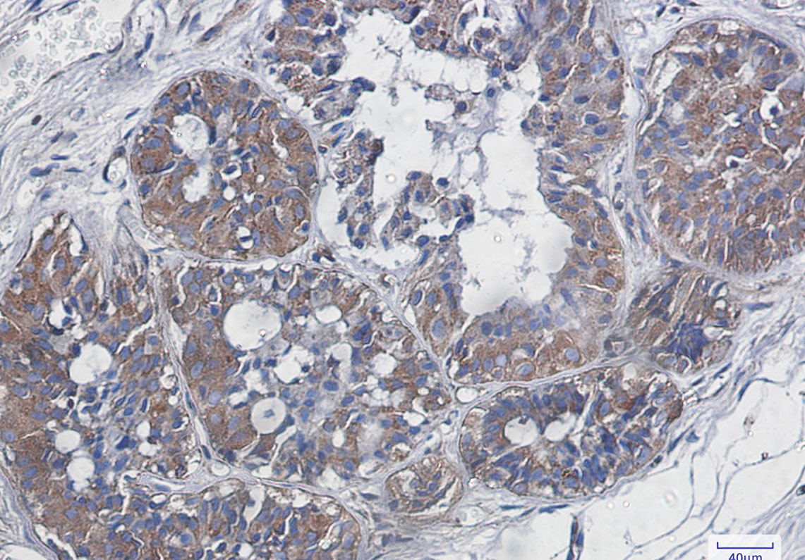 NF-KB p65 Rabbit mAb