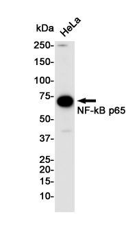 NF-KB p65 Rabbit mAb