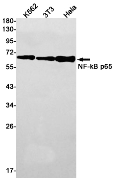 NF-KB p65 Rabbit mAb