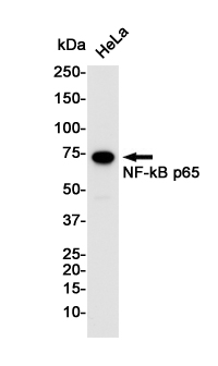 NF-KB p65 Rabbit mAb