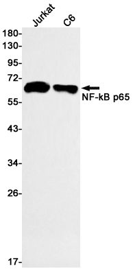 NF-KB p65 Rabbit mAb