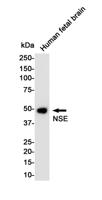 NSE Rabbit mAb