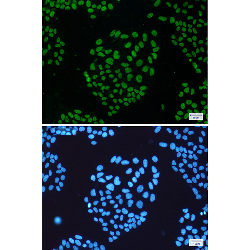 THO Complex Subunit 1 Rabbit mAb