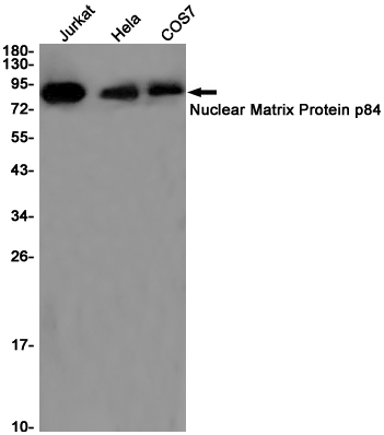 THO Complex Subunit 1 Rabbit mAb