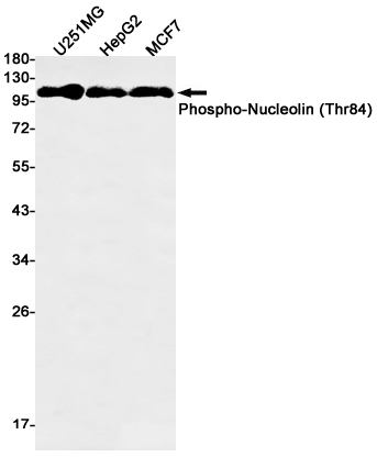 Phospho-Nucleolin (Thr84) Rabbit mAb