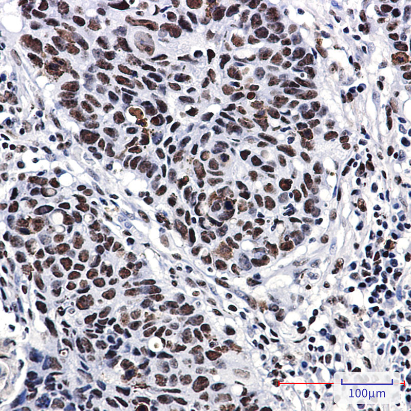 Nucleophosmin Rabbit mAb