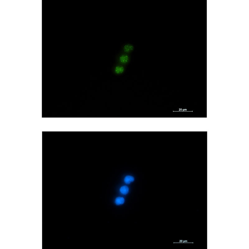 NXF1 Rabbit mAb