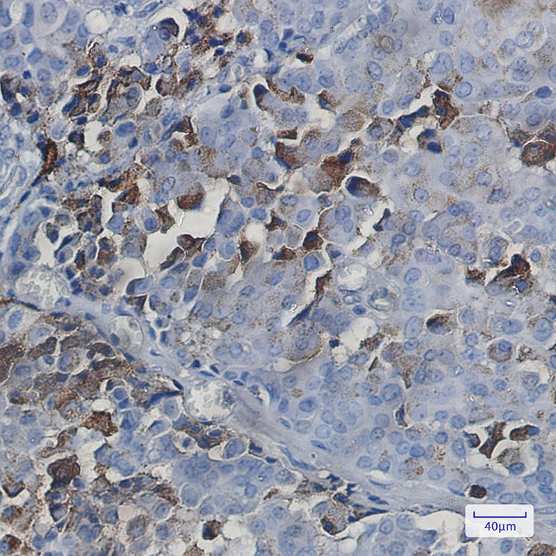 NXF1 Rabbit mAb