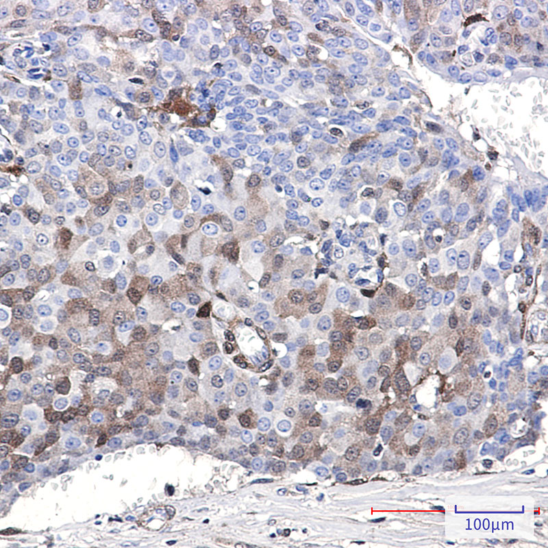 CDKN2C Rabbit mAb