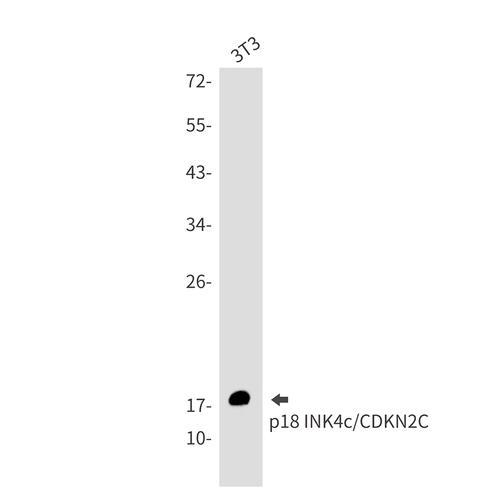 CDKN2C Rabbit mAb