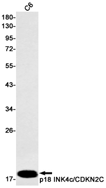 CDKN2C Rabbit mAb