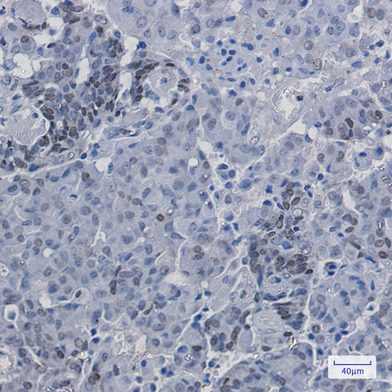 Phospho-p27 Kip 1 (Ser10) Rabbit mAb