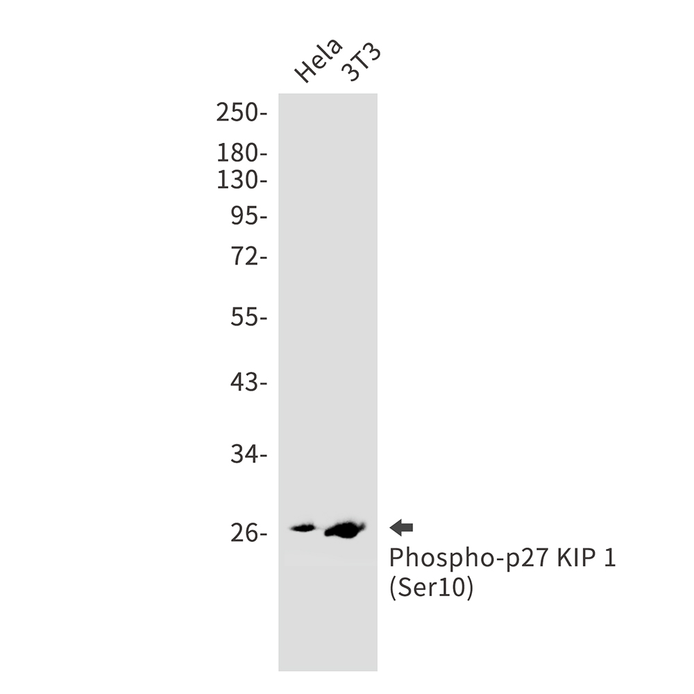 Phospho-p27 Kip 1 (Ser10) Rabbit mAb