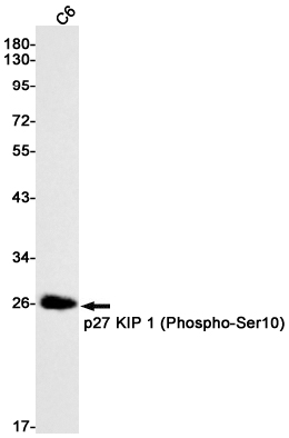 Phospho-p27 Kip 1 (Ser10) Rabbit mAb