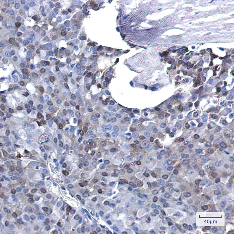 p27 Kip 1 Rabbit mAb