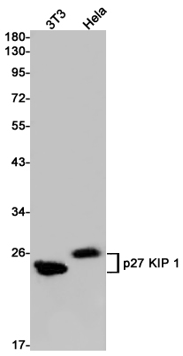 p27 Kip 1 Rabbit mAb