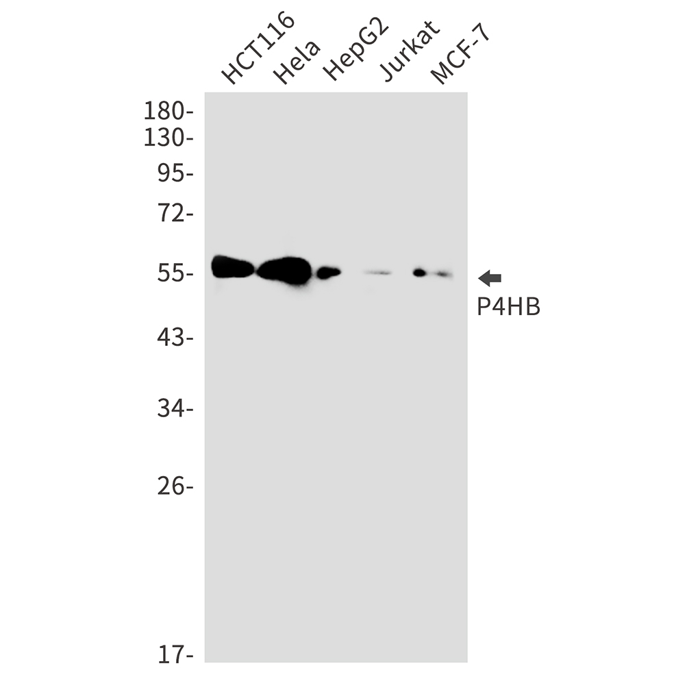 P4HB Rabbit mAb