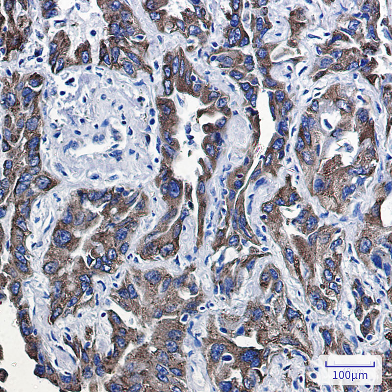 P4HB Rabbit mAb