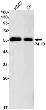 P4HB Rabbit mAb