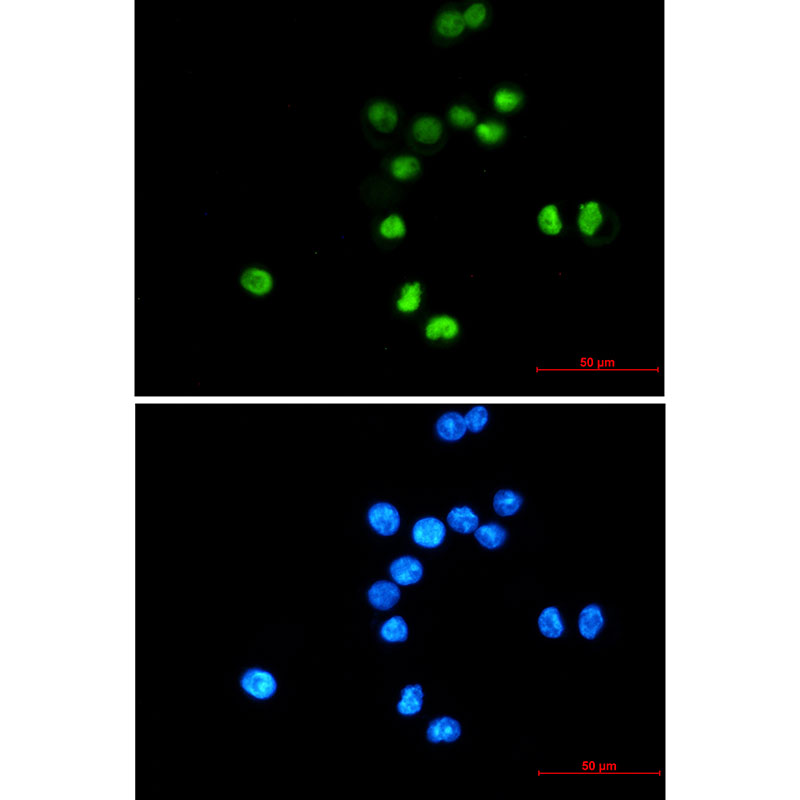 p53 Rabbit mAb