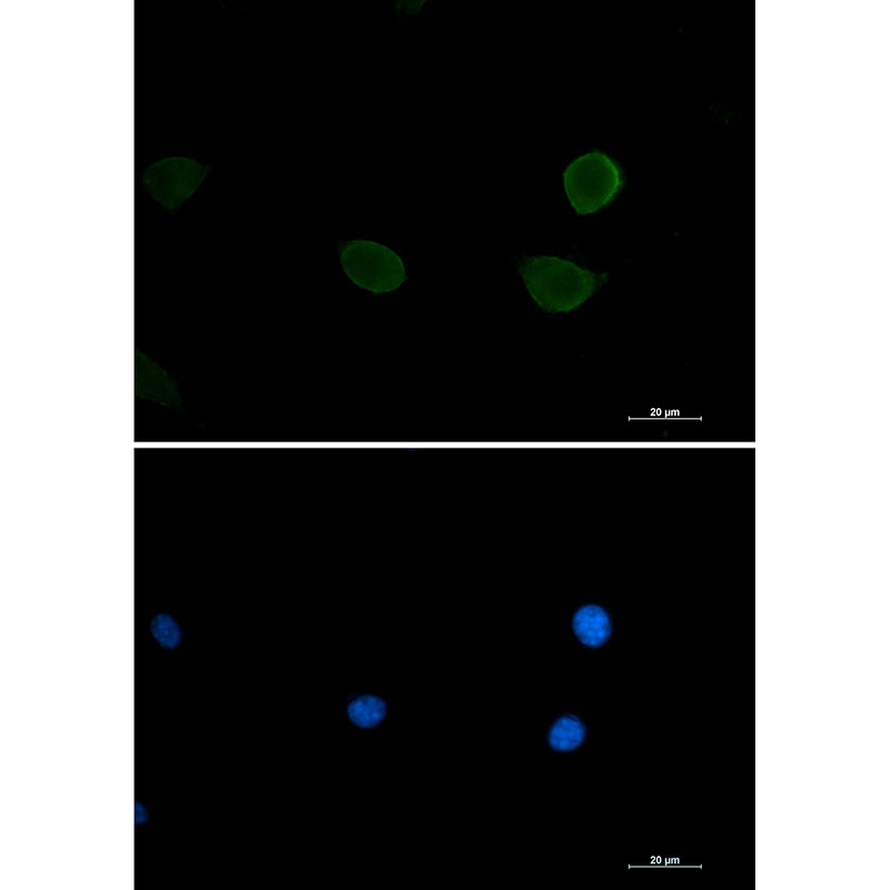 S6K2 Rabbit mAb