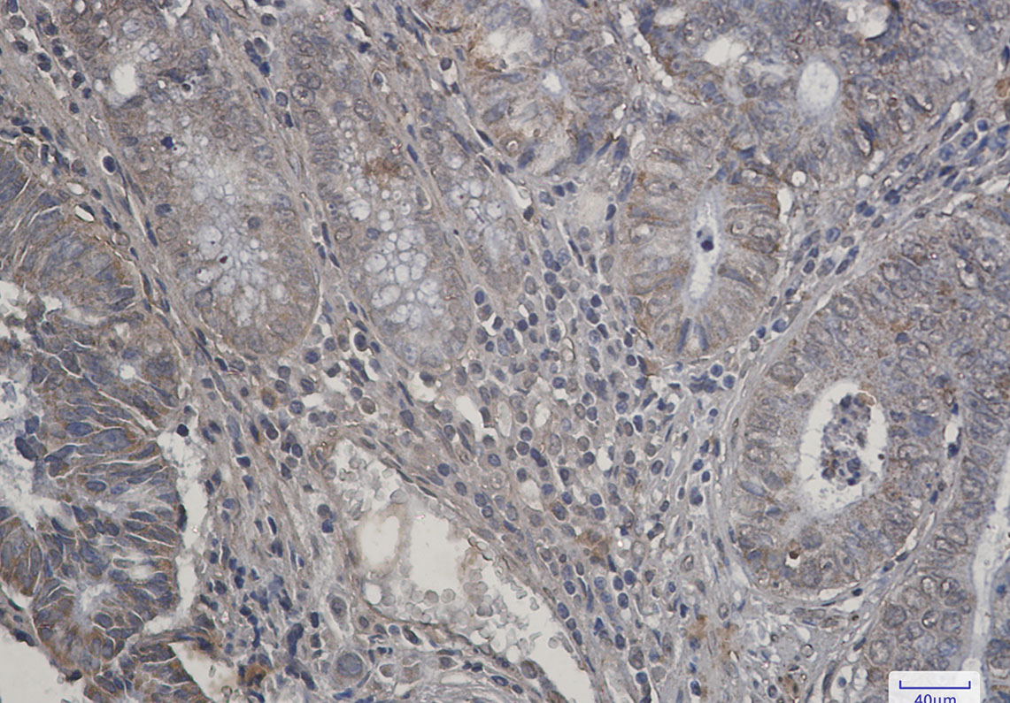 S6K2 Rabbit mAb