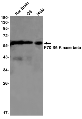 S6K2 Rabbit mAb