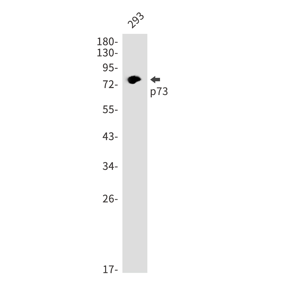 p73 Rabbit mAb