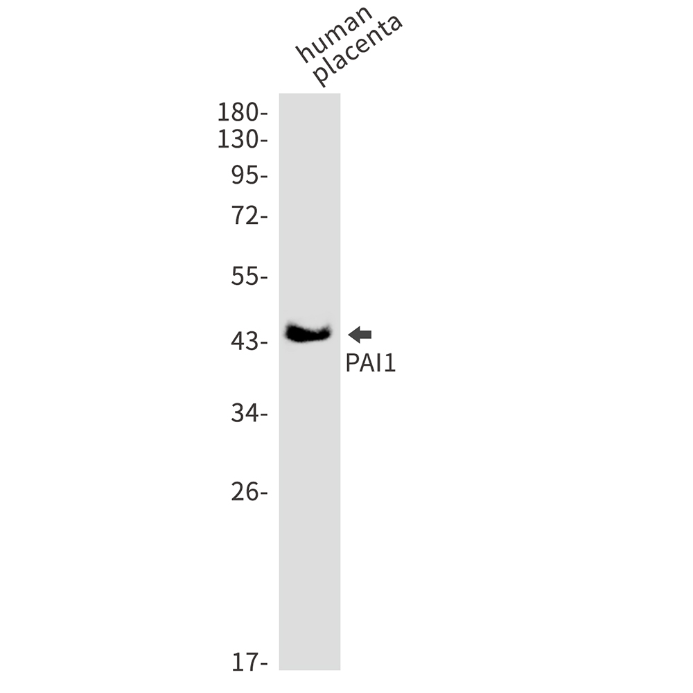 PAI1 Rabbit mAb