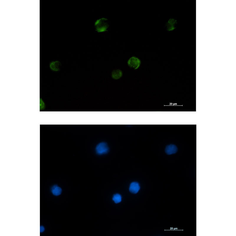 PAK1 Rabbit mAb