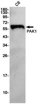 PAK1 Rabbit mAb