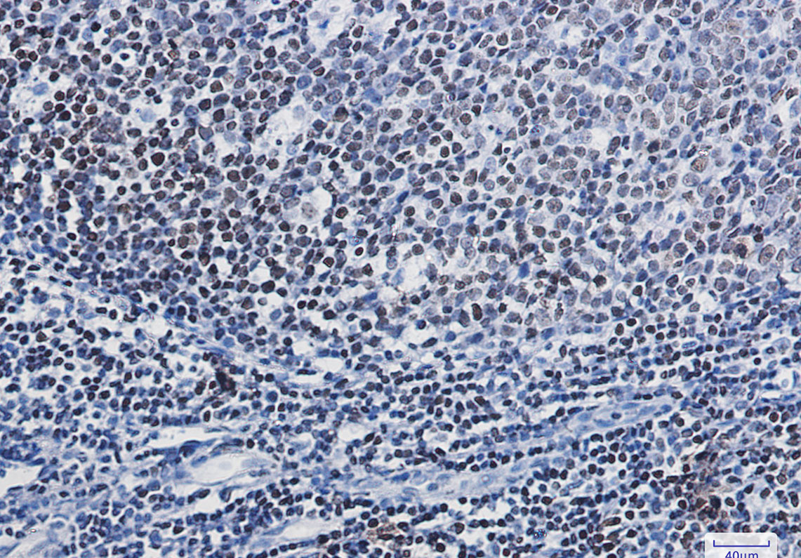 PARP1 Rabbit mAb