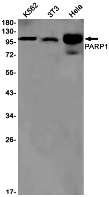 PARP1 Rabbit mAb