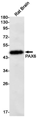 PAX6 Rabbit mAb