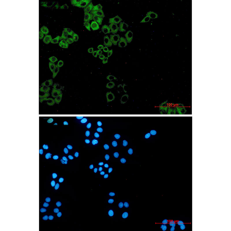 Paxillin Rabbit mAb