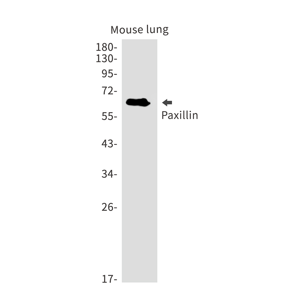 Paxillin Rabbit mAb