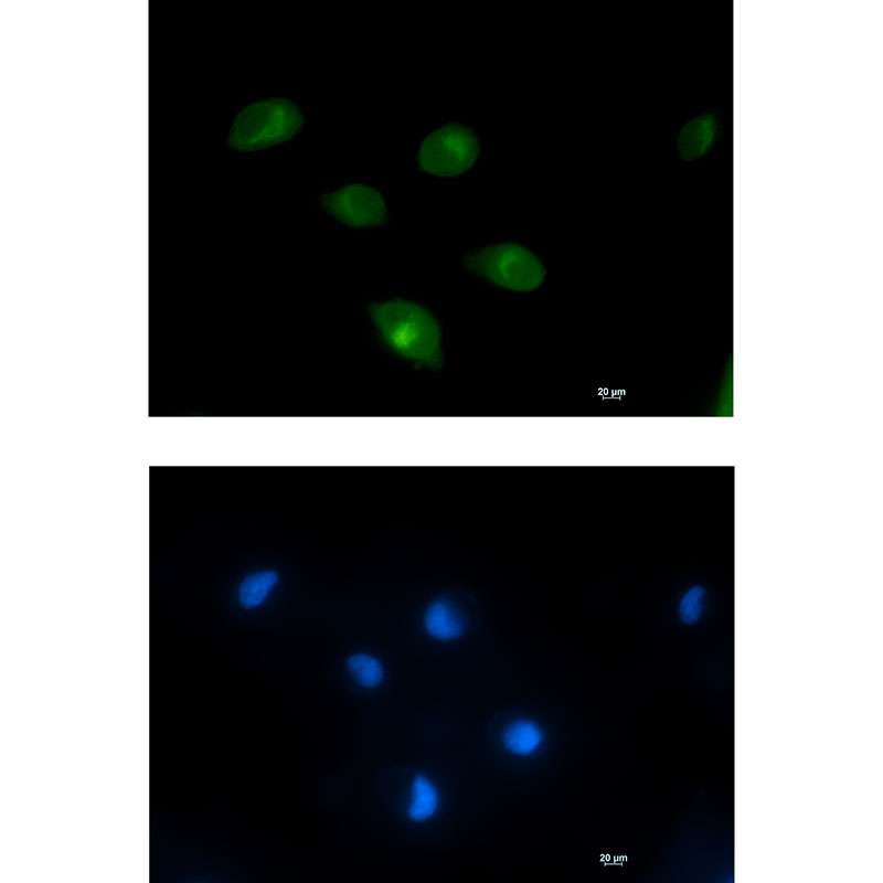 PCK2 Rabbit mAb