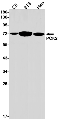 PCK2 Rabbit mAb