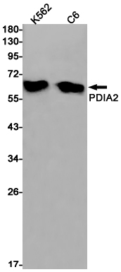 P4HB Rabbit mAb