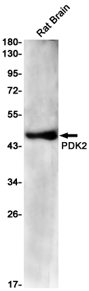 PDK2 Rabbit mAb