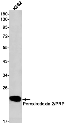 Peroxiredoxin 2 Rabbit mAb