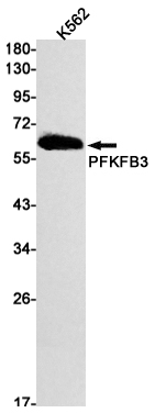 PFKFB3 Rabbit mAb