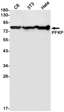 PFKP Rabbit mAb